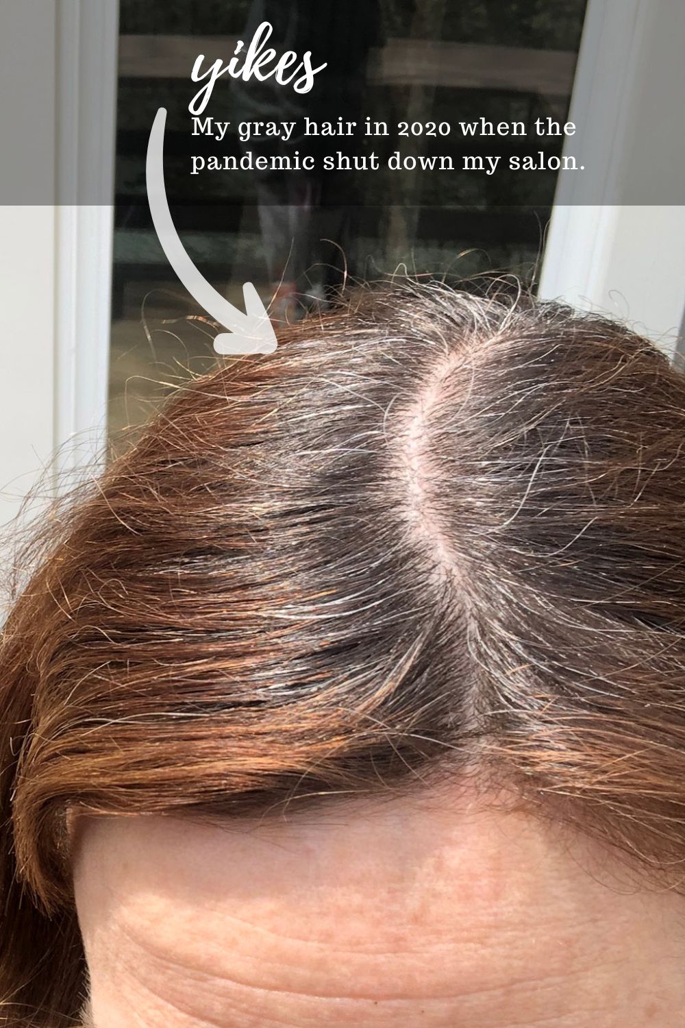Get rid of gray hair without dye? Here are 2 solutions I tried (with before & after pics) 1 Close-up of women's hair with gray roots.